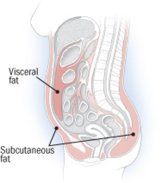 Eliminating Visceral Fat 49